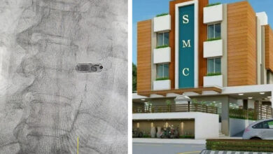 SMC अस्पताल रायपुर में लगाया गया बिना तार वाला पेसमेकर…