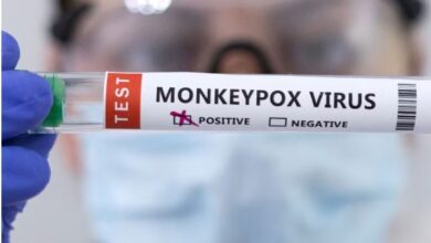 दुबई से आया युवक आरयूएचएस अस्पताल में भर्ती, चिकन पॉक्स पाया गया