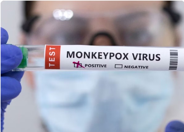 दुबई से आया युवक आरयूएचएस अस्पताल में भर्ती, चिकन पॉक्स पाया गया