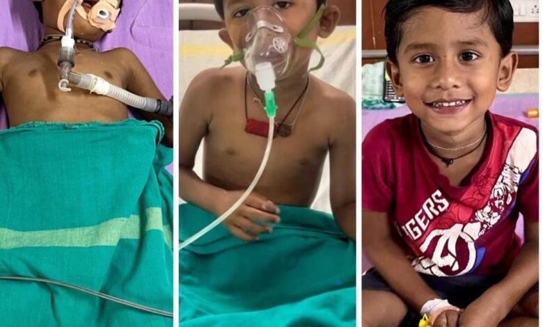 करैत के डसने से मरणासन्न मासूम को मेडिकल कॉलेज हॉस्पिटल में मिला नया जीवन