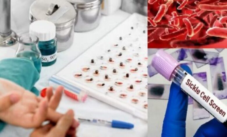सिकल सेल स्क्रीनिंग में मध्यप्रदेश देश का अग्रणी राज्य