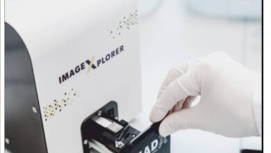 छत्तीसगढ़ का पहला सीआरडी मशीन वृंदा चेस्ट एलर्जी सेंटर में, मशीन से टेस्ट कराने पर एलर्जी का चलेगा पता, मिल सकेगी बीमारी से निजात