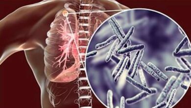 टीबी से मौत रोकने के लिए तमिलनाडु सरकार की नई रणनीति कारगर